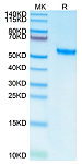Recombinant Human ROR2 Protein (RP02479)