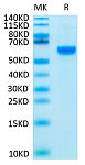 Biotinylated Recombinant Human ROR2 Protein (RP02480)