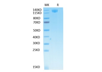 Biotinylated Recombinant SARS-CoV Spike S1 Protein