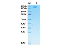 Biotinylated Recombinant SARS-CoV Spike S1 Protein (RP02485)