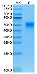Biotinylated Recombinant Human Fc-gamma RIII alpha/CD16a(F176)  Protein (RP02536)