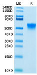 Biotinylated Recombinant Human FGFR3 beta (IIIc)/CD333 Protein (RP02547)