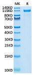 Recombinant Human ErbB-2/HER2/CD340 Protein (RP02552)