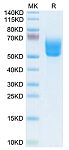 Biotinylated Recombinant Human Dkk-3 Protein (RP02554)
