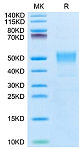 Biotinylated Recombinant Human TROP-2/TACSTD2 Protein (RP02570)