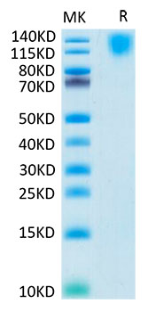 Biotinylated Recombinant Human CEA/CD66e Protein