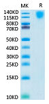 Biotinylated Recombinant Human CEA/CD66e Protein (RP02573)