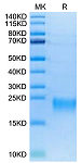 Biotinylated Recombinant Human TNFRSF13C/BAFF-R/CD268 Protein (RP02582)