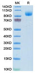 Recombinant Mouse IFNAR1/IFN alpha/beta R1 Protein (RP02612)