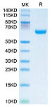 Recombinant Human OSCAR Protein (RP02616)