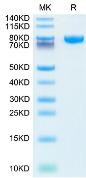 Recombinant Human IL-18 R beta/IL-1 R7/CD218b Protein