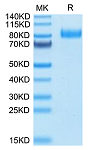Recombinant Human B7-H7/HHLA2 Protein (RP02620)