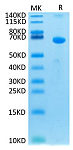 Recombinant Human TSLPR Protein (RP02623)