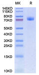 Recombinant Human GFRAL/GFR alpha-like Protein (RP02625)