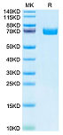 Recombinant Human EPHB2 Protein (RP02657)