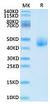 Recombinant Human DLK1 Protein (RP02662)