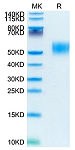 Recombinant Mouse GM-CSF R alpha Protein (RP02663)