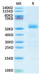 Recombinant Mouse DLL3 Protein (RP02664)