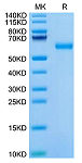 Recombinant Mouse ROR1 Protein (RP02668)