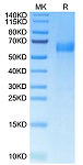 Recombinant Human B7-H7/HHLA2 Protein (RP02675)