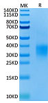 Recombinant Mouse GITR/TNFRSF18 Protein (RP02678)