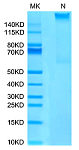 Recombinant Human MAGE-A4 (HLA-A*02:01) Complex Tetramer Protein (RP02692)