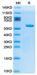Recombinant Human AFP (HLA-A*02:01) Complex Protein (RP02693)