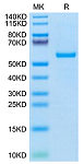 Recombinant Human KRAS WT(HLA-A*03:01) Protein (RP02701)