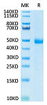 Recombinant Human KIR3DL3 Protein (RP02711)