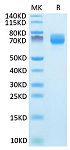 Recombinant Mouse ARTN Protein (RP02718)
