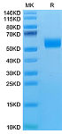 Recombinant Mouse NKG2D/CD314 Protein (RP02720)