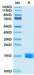Recombinant Human MARCO Protein (RP02733)