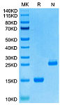 Recombinant Human GDF15 Protein (RP02740)