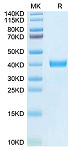 Recombinant Human MFAP4 Protein (RP02746)