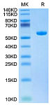 Biotinylated Recombinant  Human HBV(HLA-A*02:01) Protein (RP02754)