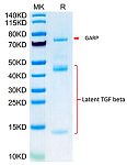 Biotinylated Recombinant  Mouse GARP&Latent TGF beta 1 Complex Protein (RP02766)
