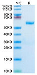 Recombinant Human RNF43 Protein (RP02777)