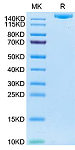 Recombinant Human IGF2R Protein (RP02786)