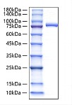 Recombinant Human Lactotransferrin Protein (RP02797)