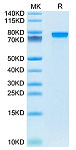 Recombinant Mouse Progranulin/PGRN/GRN Protein (RP02801)