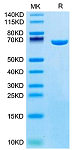 Recombinant Mouse Serum albumin/ALB Protein (RP02805)