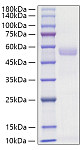 Recombinant Mouse Osteopontin/SPP1 Protein (RP02806)