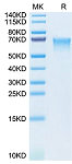 Recombinant Human MADCAM1 Protein (RP02808)