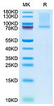 Recombinant Mouse GAS-6 Protein (RP02814)