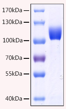 Recombinant Human CD10/MME Protein