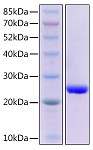 Recombinant Mouse Fas ligand/APTL/CD95 ligand/CD178 Protein (RP02829)