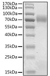 Recombinant Human Angiopoietin-like 8/ANGPTL8 Protein (RP02831)