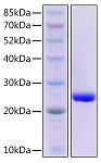 Recombinant Human GPX4 Protein (RP02834)