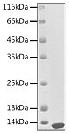 Recombinant Human HB-EGF Protein (RP02844)