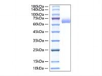 Recombinant Mouse Alkaline phosphatase Protein (RP02846)